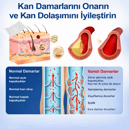 VALEGANSIA® Mikroiğneli Varis Bakım Bandı